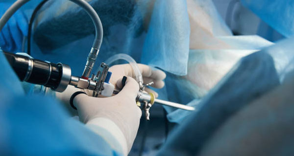 Miyomektomi Nedir? Kapalı Miyom Ameliyatı